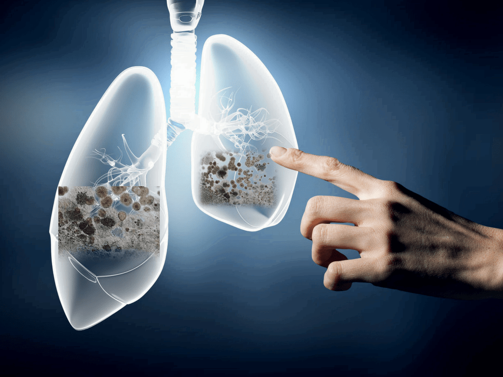 Can Mold Grow On Your Lungs 