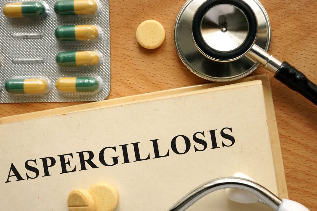 aspergillosis